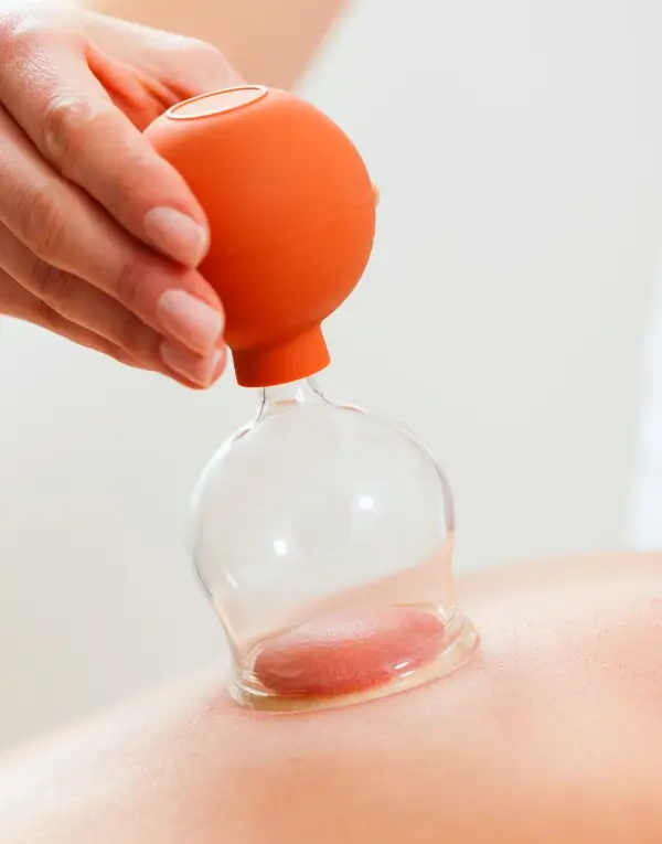 terapia con ventosas en Murcia